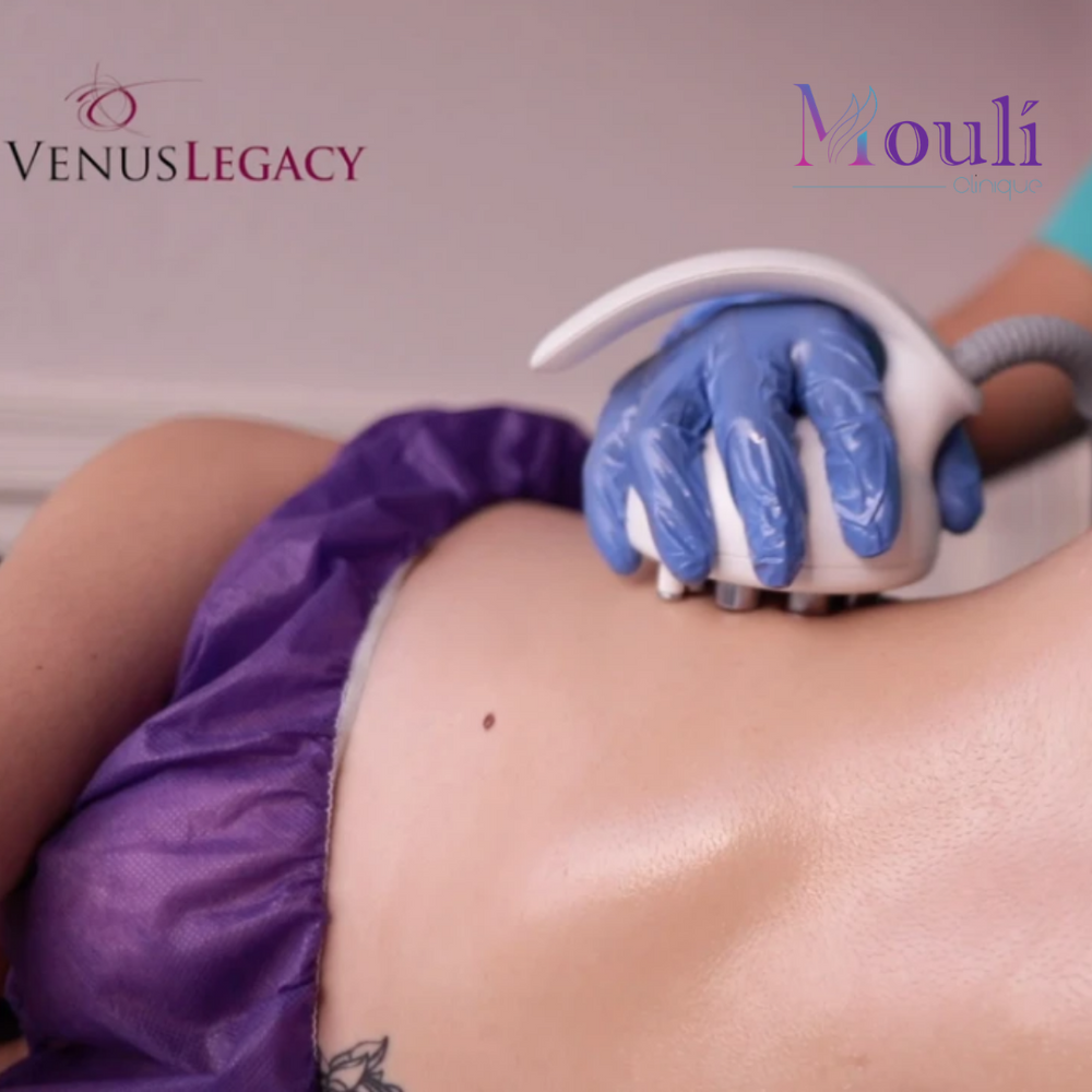 Venus Legacy